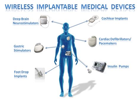 Méthacrylate de polyéthyle glycol pour la réparation osseuse et les dispositifs médicaux implantables !