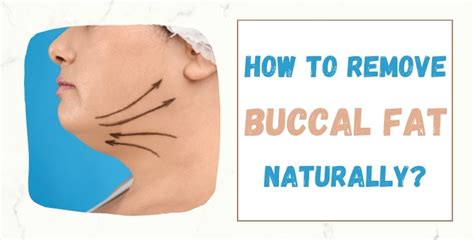 How to Remove Buccal Fat Naturally: A Comprehensive Guide to Slimming Your Face