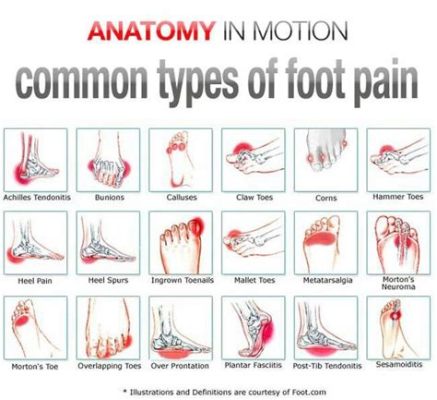 Sides of Feet Hurt When Running: Exploring the Pain and Its Peculiar Connections